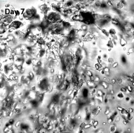 VitroGel MMPを用いた神経膠芽腫細胞（SNB 75）の三次元培養